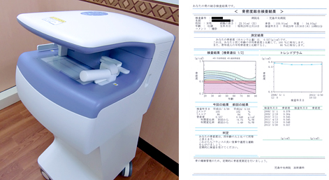 骨密度測定装置 （Aloka社製 DCS-600EXV）