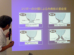 2009年9月公開医学講座の様子 痔の手術について