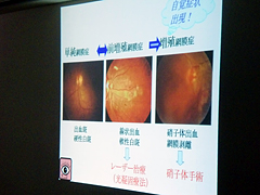 2010年6月糖尿病教室の様子